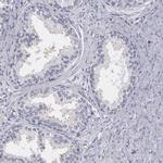 MBNL3 Antibody in Immunohistochemistry (IHC)