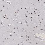 RRP7A Antibody in Immunohistochemistry (Paraffin) (IHC (P))