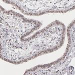 RRP7A Antibody in Immunohistochemistry (Paraffin) (IHC (P))