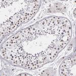 RRP7A Antibody in Immunohistochemistry (Paraffin) (IHC (P))