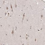 SYTL4 Antibody in Immunohistochemistry (Paraffin) (IHC (P))