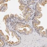 SYTL4 Antibody in Immunohistochemistry (Paraffin) (IHC (P))