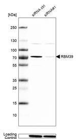 HCC1 Antibody