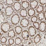 HCC1 Antibody in Immunohistochemistry (IHC)