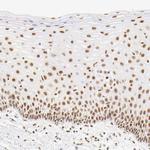 HCC1 Antibody in Immunohistochemistry (IHC)