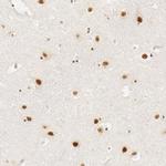 HCC1 Antibody in Immunohistochemistry (IHC)