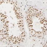 HCC1 Antibody in Immunohistochemistry (IHC)