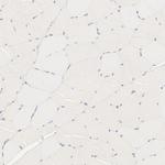 RPGR Polyclonal Antibody