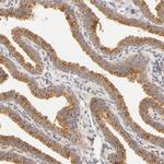 RPGR Antibody in Immunohistochemistry (IHC)