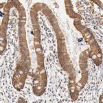 RPGR Antibody in Immunohistochemistry (IHC)