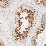 RPGR Antibody in Immunohistochemistry (IHC)