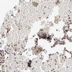 MXD1 Antibody in Immunohistochemistry (IHC)