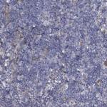 Fibulin 1 Polyclonal Antibody