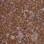 RIOK3 Polyclonal Antibody