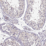 PNP Antibody in Immunohistochemistry (Paraffin) (IHC (P))