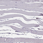 PNP Antibody in Immunohistochemistry (Paraffin) (IHC (P))