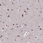 INPP4A Antibody in Immunohistochemistry (Paraffin) (IHC (P))