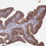 INPP4A Antibody in Immunohistochemistry (Paraffin) (IHC (P))