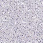 INPP4A Antibody in Immunohistochemistry (Paraffin) (IHC (P))