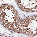 INPP4A Antibody in Immunohistochemistry (Paraffin) (IHC (P))