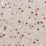 RBM22 Antibody in Immunohistochemistry (Paraffin) (IHC (P))