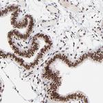 RBM22 Antibody in Immunohistochemistry (Paraffin) (IHC (P))