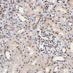 RBM22 Antibody in Immunohistochemistry (Paraffin) (IHC (P))