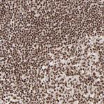 RBM22 Antibody in Immunohistochemistry (Paraffin) (IHC (P))