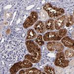 RBP4 Antibody in Immunohistochemistry (Paraffin) (IHC (P))