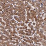 RBP4 Antibody in Immunohistochemistry (Paraffin) (IHC (P))