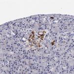 RBP4 Polyclonal Antibody