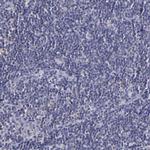 RBP4 Antibody in Immunohistochemistry (Paraffin) (IHC (P))