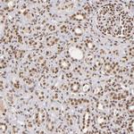 ZNF148 Antibody in Immunohistochemistry (Paraffin) (IHC (P))