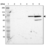 ZNF234 Antibody in Western Blot (WB)
