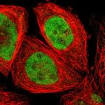 ZNF75A Polyclonal Antibody