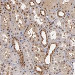 ZNF75A Antibody in Immunohistochemistry (Paraffin) (IHC (P))