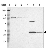 ZNF75A Antibody in Western Blot (WB)