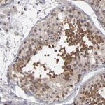 GLCCI1 Antibody in Immunohistochemistry (IHC)