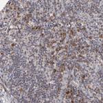 GLCCI1 Antibody in Immunohistochemistry (IHC)
