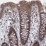 GLCCI1 Antibody in Immunohistochemistry (IHC)