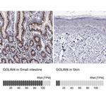 GOLIM4 Antibody in Immunohistochemistry (IHC)