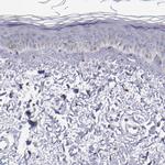 GOLIM4 Antibody in Immunohistochemistry (IHC)