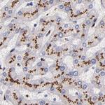 GOLIM4 Antibody in Immunohistochemistry (IHC)