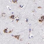 GOLIM4 Antibody in Immunohistochemistry (IHC)