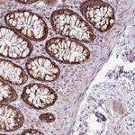 ZNF81 Polyclonal Antibody