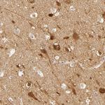 SAP102 Antibody in Immunohistochemistry (Paraffin) (IHC (P))