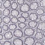 SAP102 Antibody in Immunohistochemistry (Paraffin) (IHC (P))