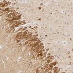 SAP102 Antibody in Immunohistochemistry (Paraffin) (IHC (P))