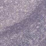 SAP102 Antibody in Immunohistochemistry (Paraffin) (IHC (P))