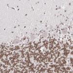 ZFX Antibody in Immunohistochemistry (Paraffin) (IHC (P))
